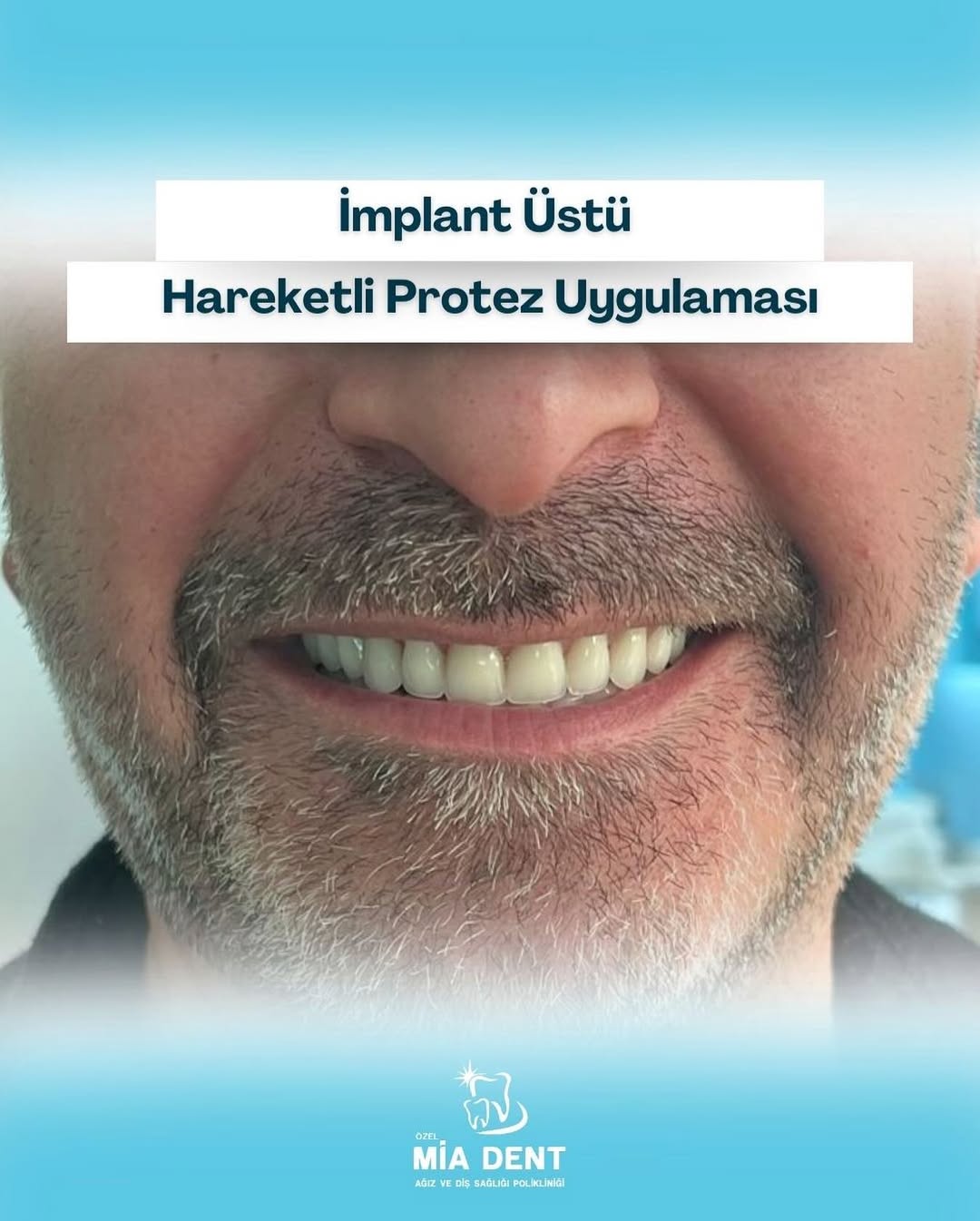 Bursa Diş Hekimi