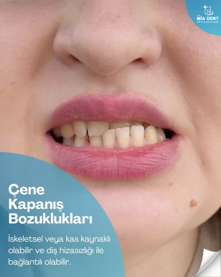Bursa Diş Hekimi